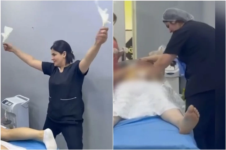 El Ministerio de Sanidad ha comentado los vídeos de una operación estética que se difundieron en redes sociales