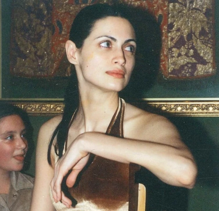 Icono de Belleza de Azerbaiyán Lucha Contra el Cáncer