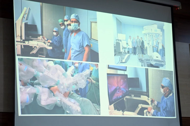 Cirujanos de Azerbaiyán y China realizan una operación robótica y a distancia